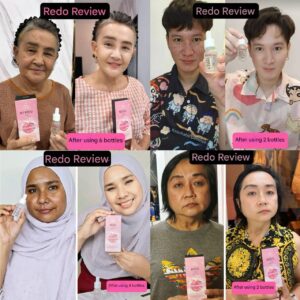 Reface Serum